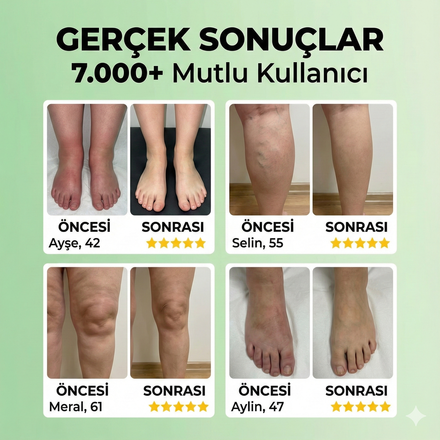 Yalvisi™ Bitkisel Krem